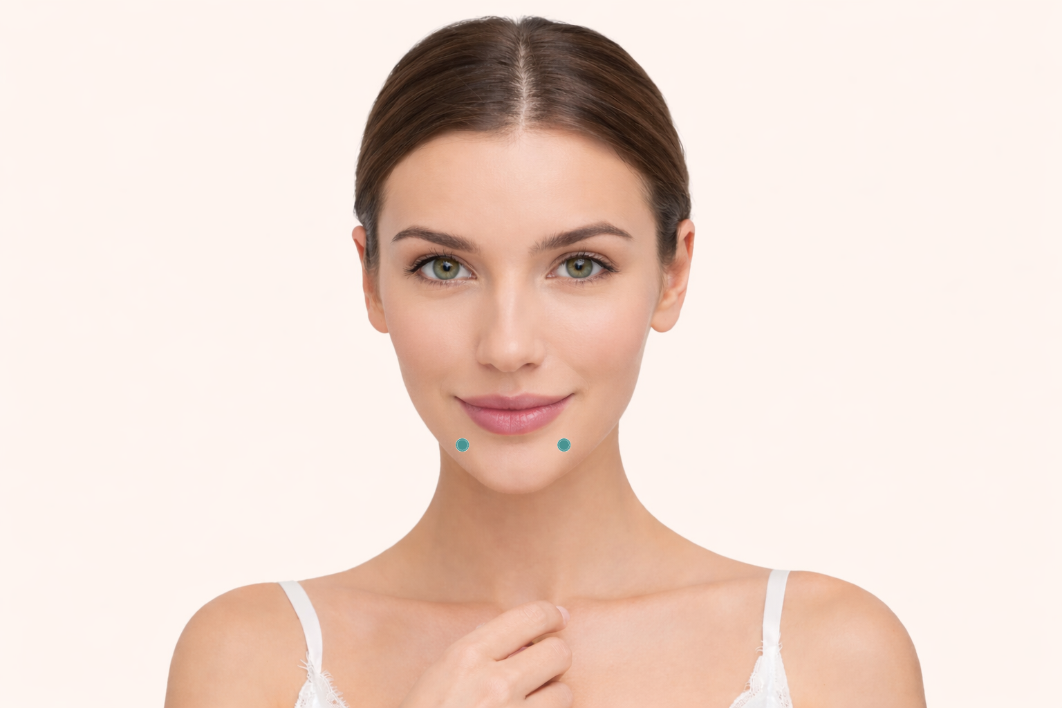 Botox behandeling - Mondhoeken